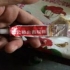 快走银屑病