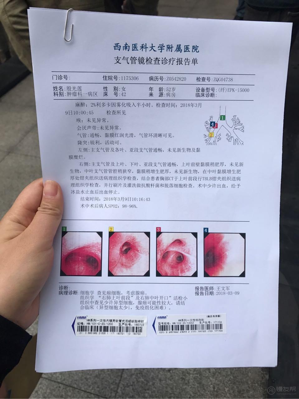 eoenmxv的主页 - 慢友帮